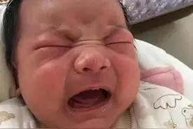 新生儿的“5个脸面工程”很重要，家长做不对，会导致孩子变丑图片