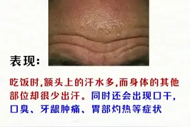 头汗、脖汗、腋汗、背汗，中成药帮你搞定内脏健康图片