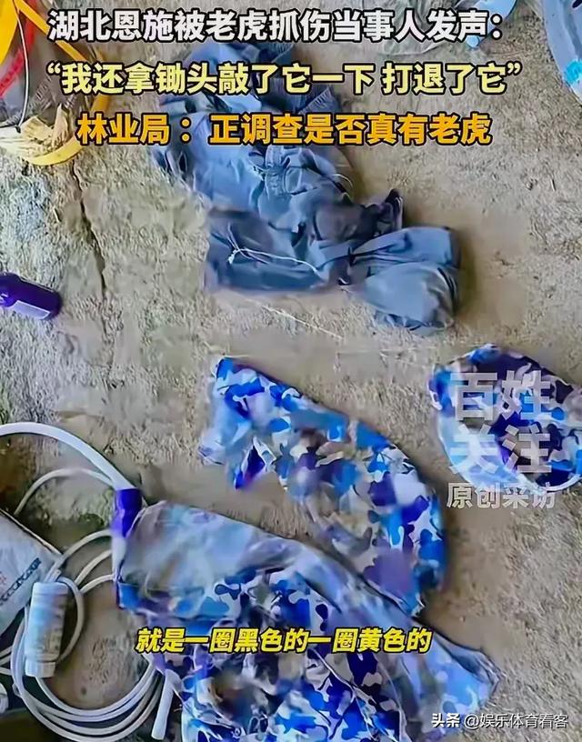 湖北恩施一村民干农活时被老虎抓伤：持锄头敲了它几下 摇摇头走了