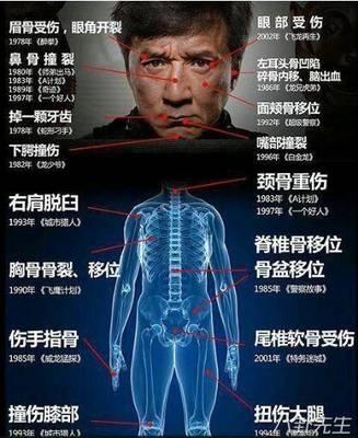 张晋何止是心脏支架，曝光身体累垮？唯恐蔡少芬"老妻送少夫"