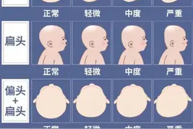 小心！婴儿出现这4个问题要趁早干预呀！图片