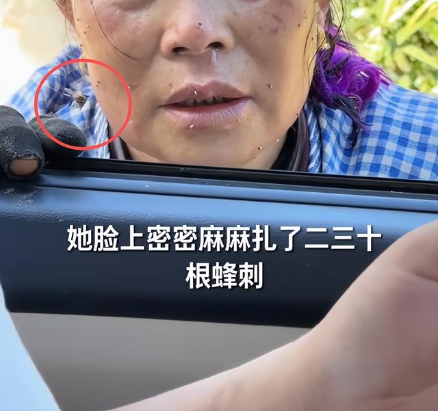 云南大姨被蜜蜂狂蜇，满脸蜂刺求助，过路司机惊呆，网友直呼惊险
