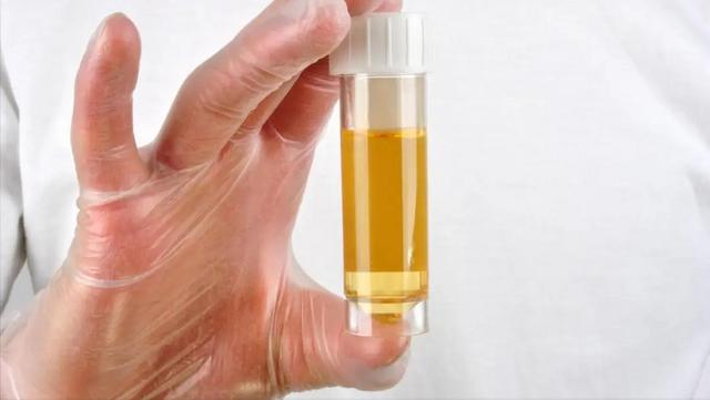 慢性肾衰竭的分期标准是什么？肌酐多少算肾衰竭？详细解析