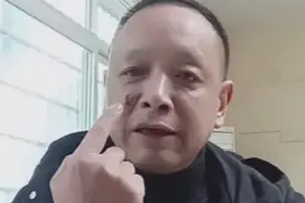 “痛！”男子住酒店，第二天醒来竟发现…店长：开业15年来第一次遇到图片