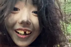 景区“美女野人”身份被扒，千万粉丝，曾因踩狗尿，摔掉一颗门牙图片