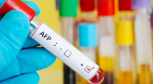 调查发现：每天都喝酒的人，多数到了65岁以后	，身体或变成这样？