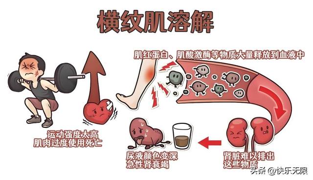 健身猛如虎，尿出酱油色！医生警告：这事别硬扛