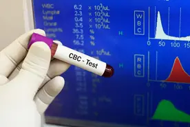 在血常规检查中，一高两低才是最要命的，希望你正常！图片