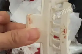 不要戴鲨鱼夹！女子穿拖鞋摔倒头朝地，鲨鱼夹插入后脑勺，缝两针图片