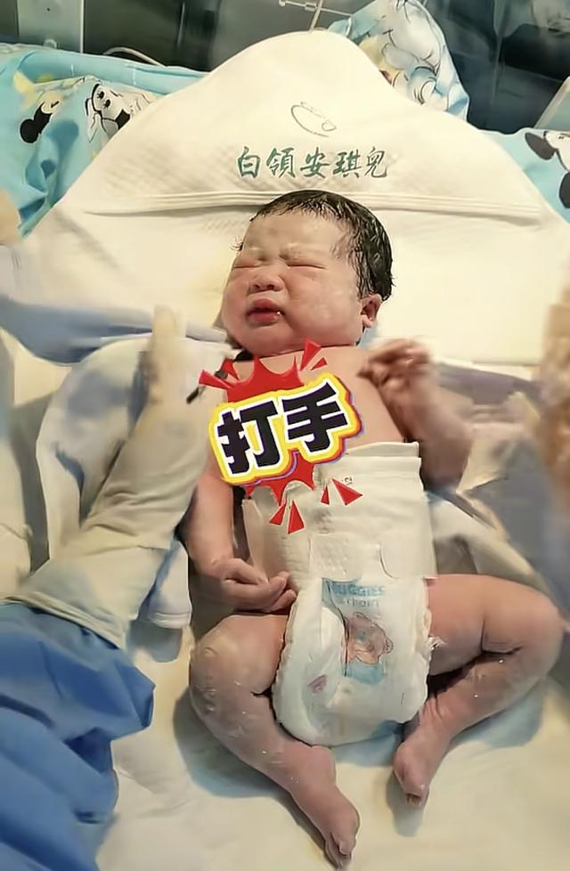 “最惨新生儿”火了，因为太淡定被医生轮番“暴揍”，说好看才哭