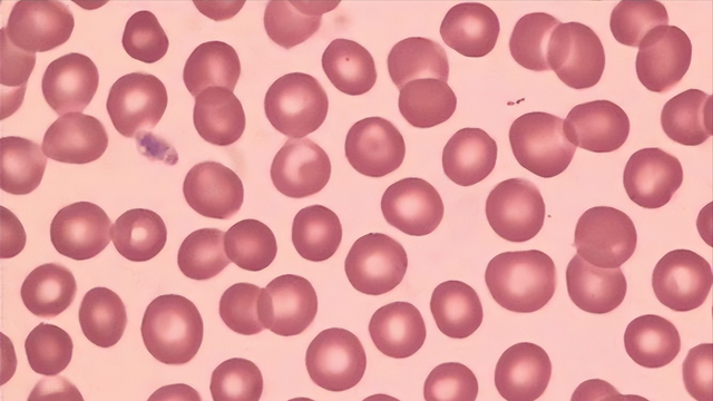 夫妻中有一人是O型血，生出的宝宝有什么特点呢？建议准爸妈了解