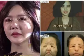 真吓人！整容界权威人士评韩安冉面部，再不控制恐面临毁容。图片