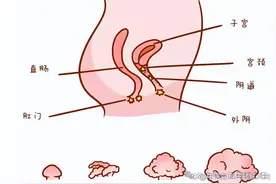 医生大实话：女人有没有感染HPV，看这几点就够了！图片
