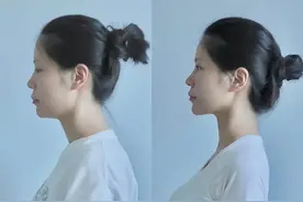 改善脖子前倾真的很简单图片