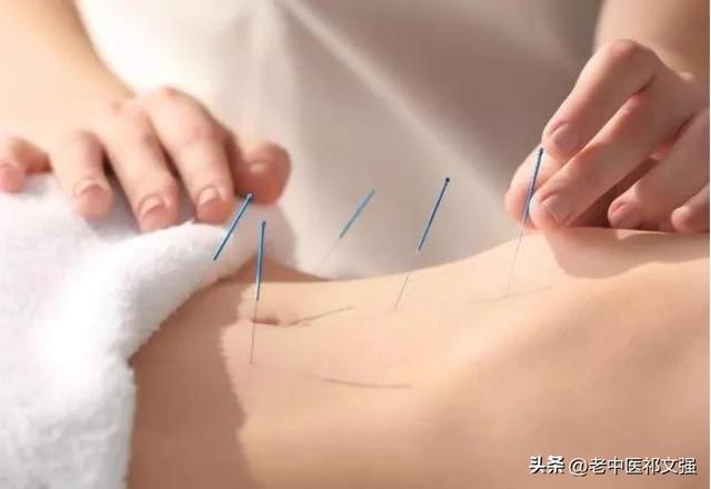 癫痫持续状态