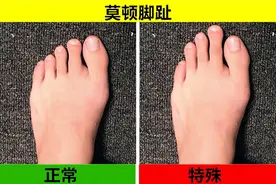 据说只有极少数人身体才有的8个特征，你看看自己有吗？图片