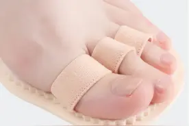 脚趾畸形似“爪子”？爪状趾了解一下图片