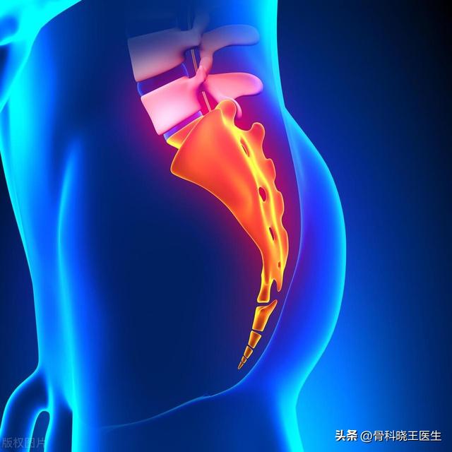 尾骨骨折很痛，怎么办？尾骨骨折后有哪些康复建议？