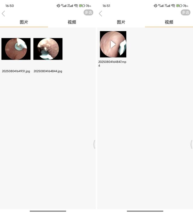 你真会掏耳朵吗？上手西圣Find X智能可视耳勺，还是年轻人会玩！