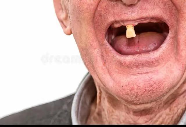 寿命长不长，牙齿先知？65岁后，掉牙多的人活得久？告诉你答案