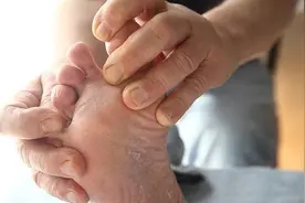 用小苏打洗脚就能治脚气、脚臭？还能预防脚气？事实是这样吗图片