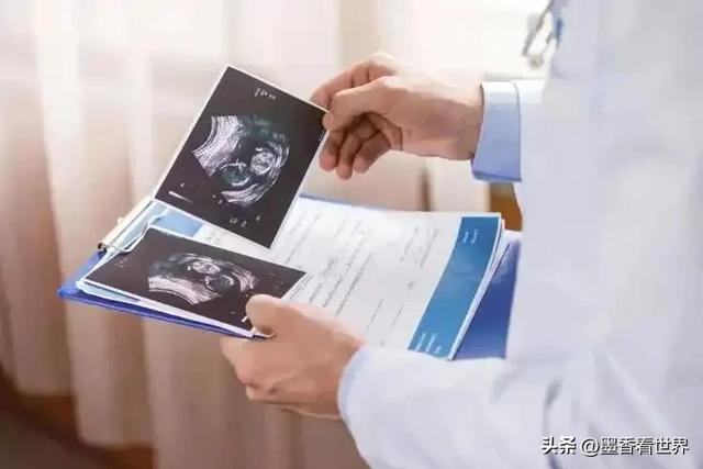 脱裤查B超？140斤胖妹当场裂开！医生一句话：误诊差点要命！