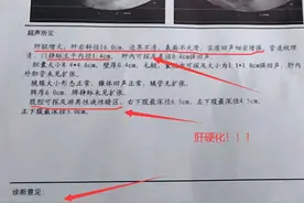 肝脏彩超没提示这5种情况，可以把心放肚子里了！图片