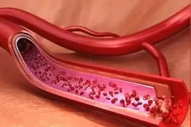 这1个动作心脏最爱，每天重复做，血管通畅，心脏强健图片