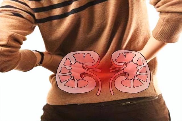 北京协和分析376名肾衰竭病人	，惊讶发现：他们几乎都有这9个共性