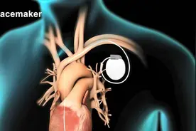 如何稳住“乱跳”的心脏？图片