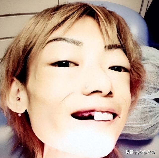 一代女神沦为豪门玩物？结婚8年牙齿全掉，器官切除，面似骷髅