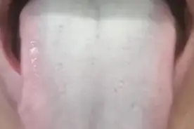 像这种舌苔，又厚又腻，刮之不去，白露用藿香正气散散结节准没错图片