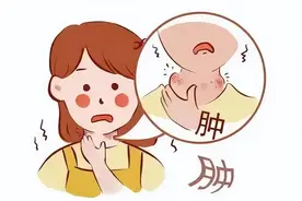 她呼吸困难，竟是胸骨后长了甲状腺肿图片