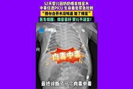 52天婴儿喝奶奶喂的蜂蜜水后中毒进ICU，医生提醒：1岁以下婴儿不宜食用蜂蜜图片