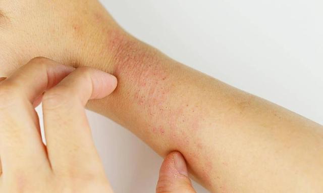 核桃立大功，医学研究发现：每天吃核桃对这3种慢性病或有好处