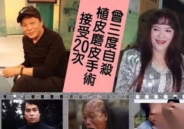 梁小龙被曝离世1天	，私生活被扒底朝天，原来他和杨少华处境一样