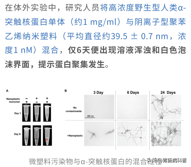 复旦大学新研究：微塑料不粘锅或损害生育力！还诱发帕金森！