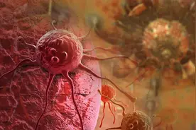 甲状腺穿刺活检，是否刺激肿瘤扩散？一文看明白图片