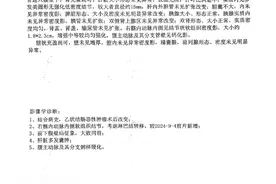 珂信肿瘤医院，我来了（二）图片