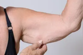 肌肉松弛是缺乏蛋白吗？老年人应该怎么补充和锻炼？图片