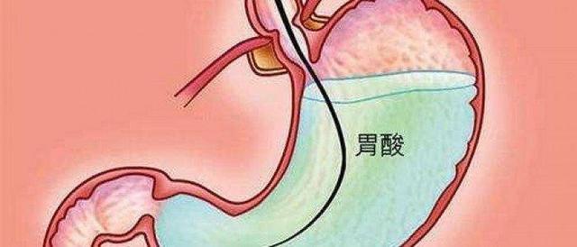 卫健委已将奥美拉唑列为重点监控药物！医生：服用千万注意5个点