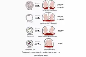 《宫斗剧的天花板：子宫内斗》图片