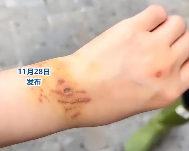 惊险！女子生理期潜水被鲨鱼咬伤，专家：血腥味有刺激