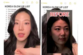 “三天15次整容”美国一女子被韩国整容迷住图片