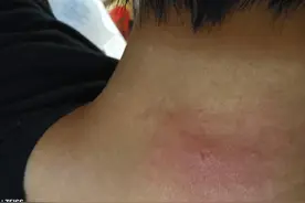 我被蜘蛛咬到了图片