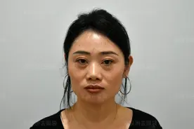 43岁咬咬牙做眼袋手术，当天出院，术后3天朋友问：真有做手术？图片