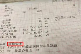 心电图“窦性心律”是什么病？心脏为何有电？心跳为何不受控制？图片