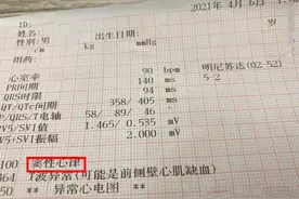 心电图“窦性心律”是什么病？心脏为何有电？心跳为何不受控制？图片