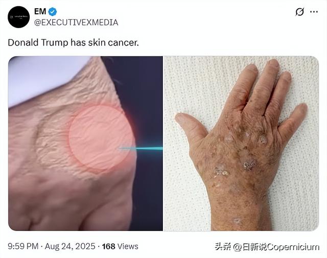 美斡旋后俄乌局势为何仍没出现好转