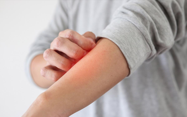 63岁男子皮肤瘙痒，以为是皮肤病	，体检后，医生叹：怎么不早来